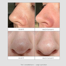 Charger l'image dans la galerie, Patch Peel Out