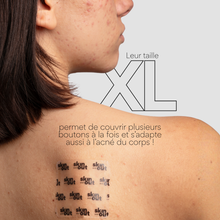 Charger l'image dans la galerie, Patchs XL boutons