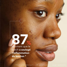 Charger l'image dans la galerie, Patchs Stop-Boutons