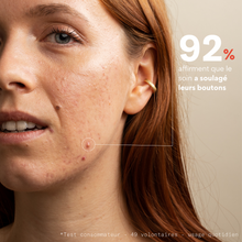 Charger l'image dans la galerie, Soin Stop-Boutons - Clear Out