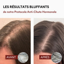 Charger l'image dans la galerie, Complément Alimentaires - DHT Blocker