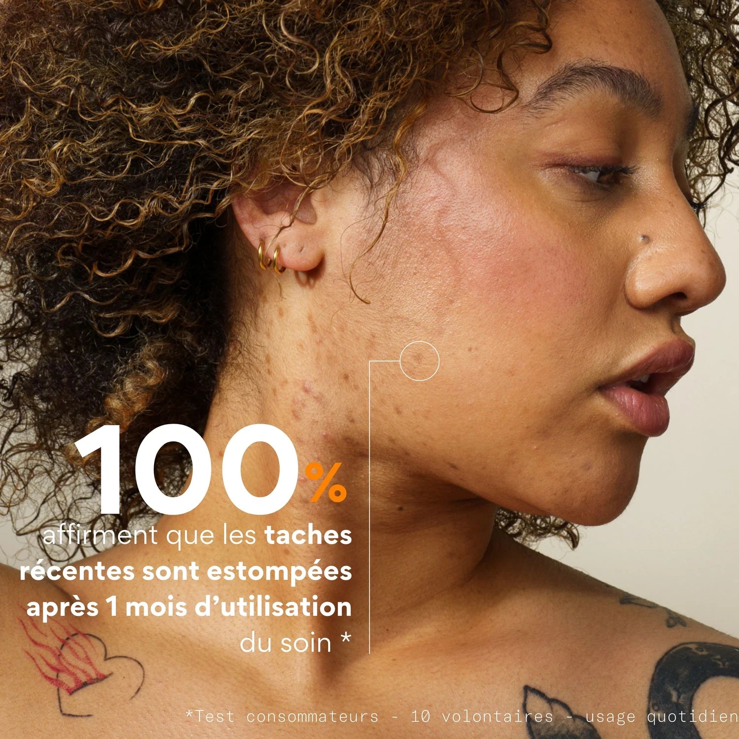Soin anti-taches acne Skin&Out - Les Procrastineuses à Tours